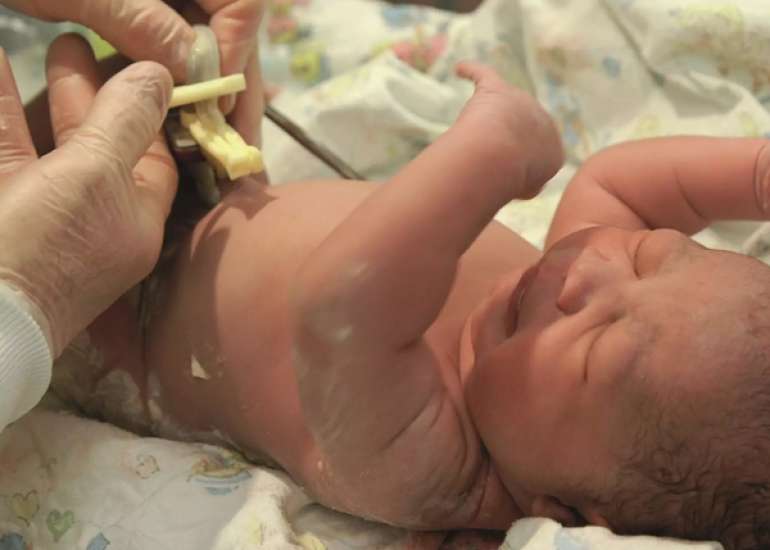 Alcohol-Based Chlorhexidine May Lower Infection Risk in Preterm Neonates