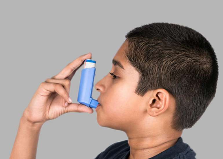 Long-term Outcomes of Severe Childhood Asthma