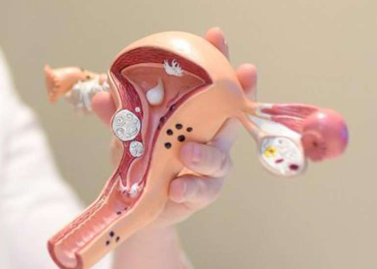 Endometrial Ablation and Subsequent Hysterectomy Risk in Women with Abnormal Uterine Bleeding