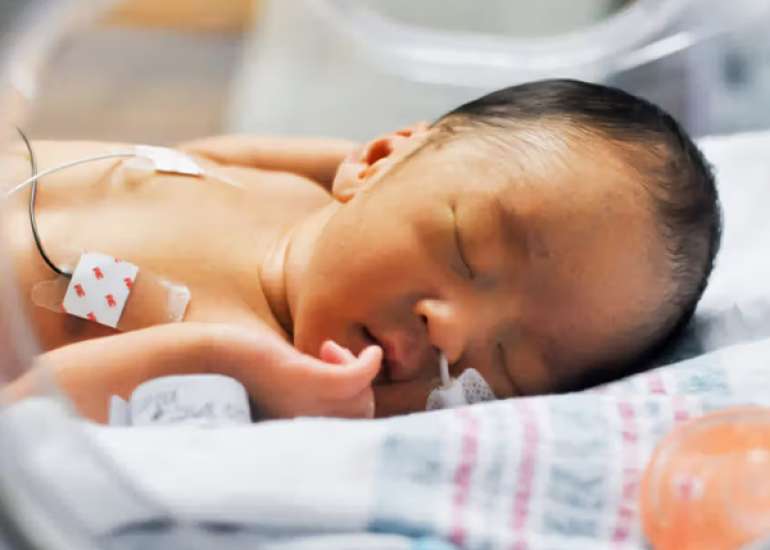Appendicitis in Infants: Why Preterm Birth Matters