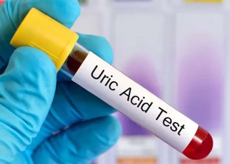 Abnormal Uric Acid Levels and Gestational Diabetes Mellitus: Is There a Link?