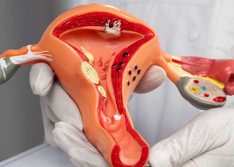 Understanding Diagnosis and Treatment of Vulvovaginal Candidiasis