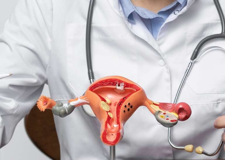 Ovarian Torsion in a Premenarcheal Girl