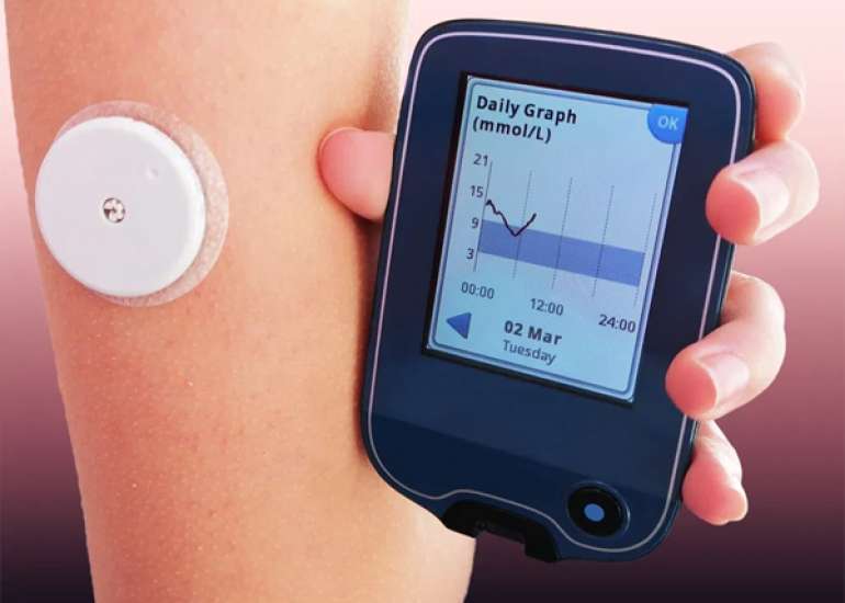 Impact of Monitoring Modality on Glycemic Outcomes in Gestational Diabetes: CGM vs Capillary Testing