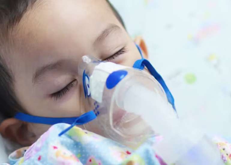 Burden and Predictors of Severe RSV Disease among Otherwise Healthy Children