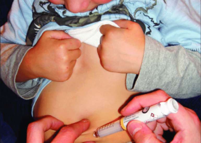 Transient Neonatal Diabetes: Successful Insulin Cessation with SAP Support