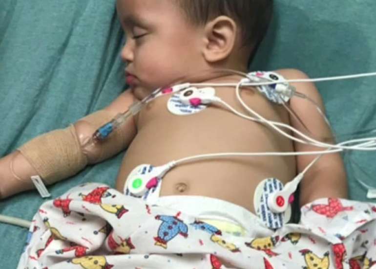 Hemodynamic Management in Pediatric Septic Shock