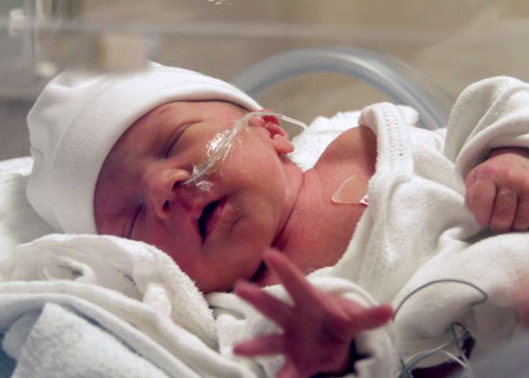 Severe Neutropenia in a Preterm Neonate