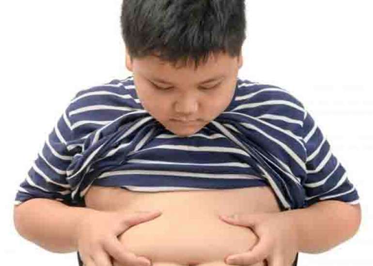 बचपन का मोटापा क्या है? कारण और इलाज