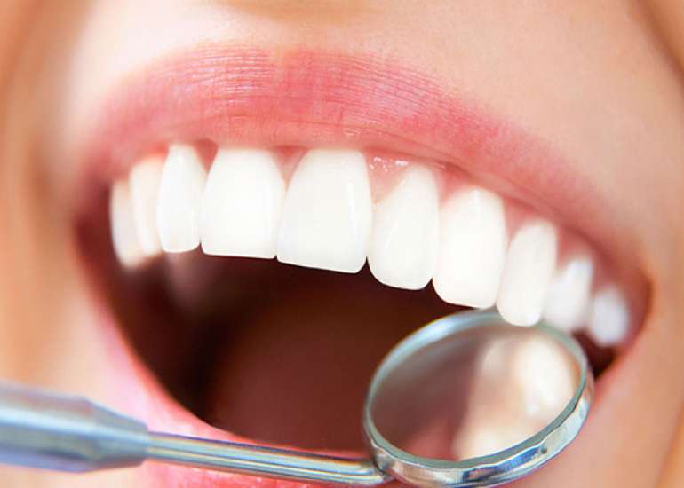 5 year survival rate in oral cancer