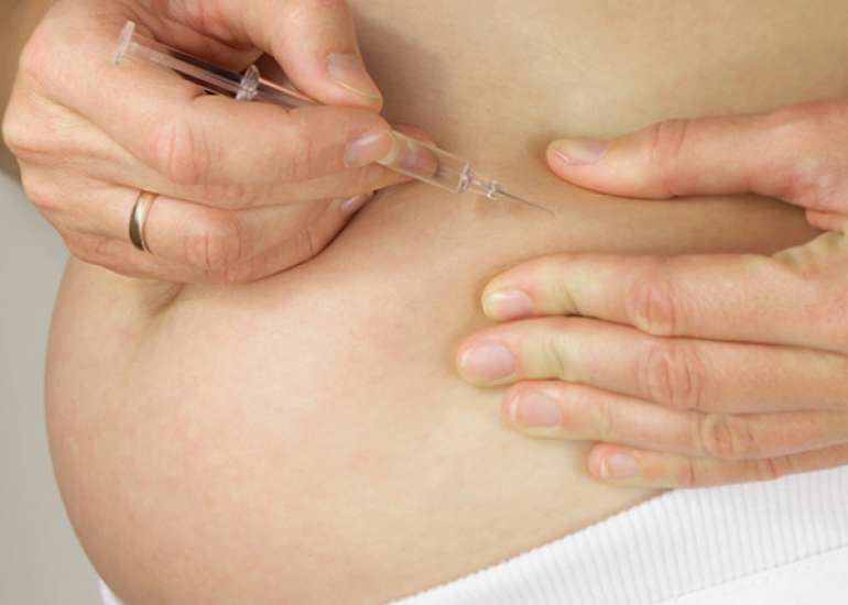 Pregnancy outcomes and adverse events of Fondaparinux and Low Molecular-Weight Heparin in Recurrent Miscarriage