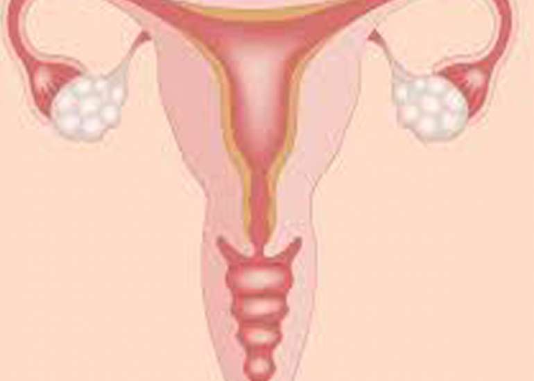 A Rare case of Dual Ovarian Pathologies