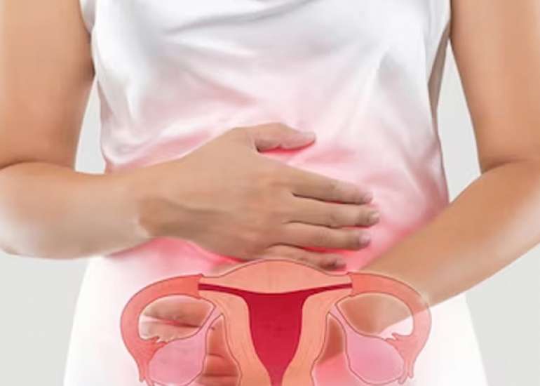 A case report of pelvic inflammatory disease – Streptococcus pneumoniae