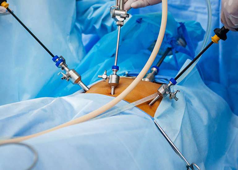 Advantage and Disadvantage of Laparoscopic Surgery?