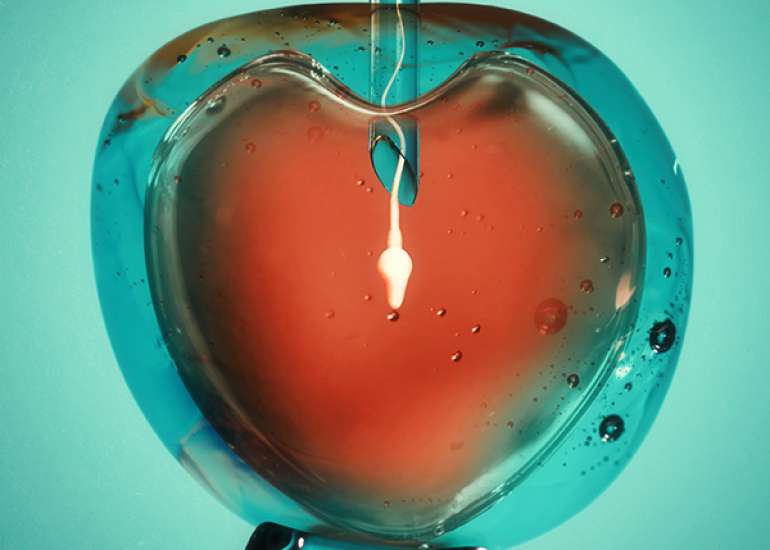 Antenatal maternity care needs of women who undergo fertility treatment