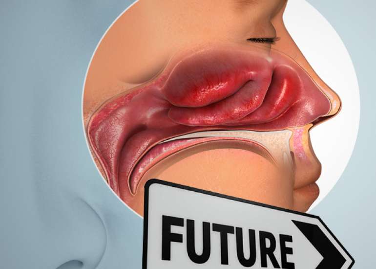 Are there any long-term effects of nasal congestion?