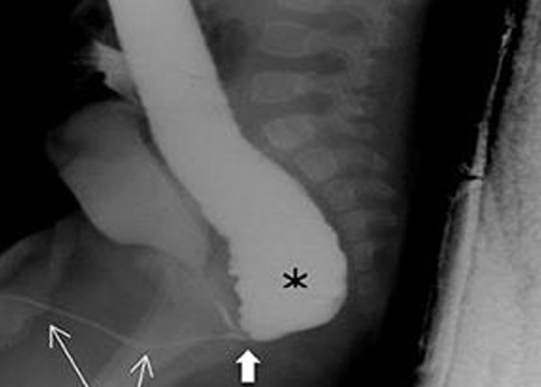 Male anorectal malformations: presurgical radiologic imaging objective and evaluation