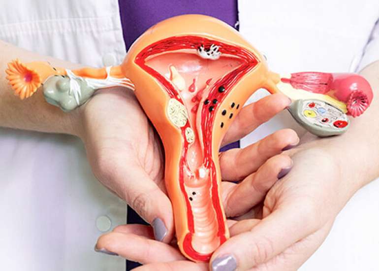 Aspiration of Endometrial Cavity with Diosmin Intake in ART Cycles