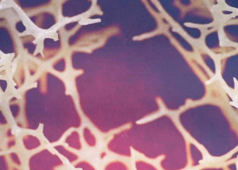 Blood and immune development in the human fetal bone marrow and Down syndrome