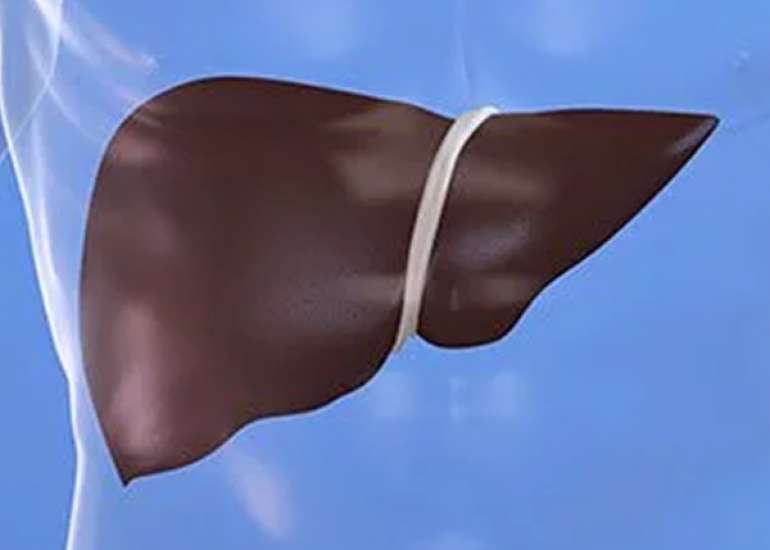 Can SGOT/SGPT level demonstrate the extent of liver damage?