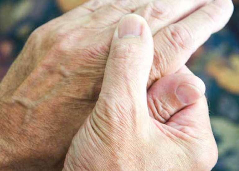 Can arthritis occur at any age?