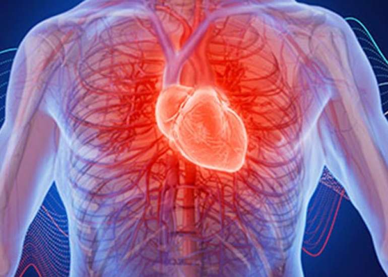  What Causes Headache and Heart Palpitation?