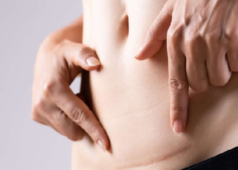 Case of cesarean scar ectopic pregnancy