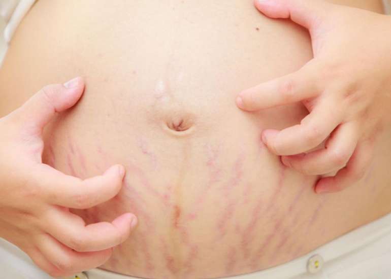 Cefuroxime axetil induced DRESS in a pregnant patient