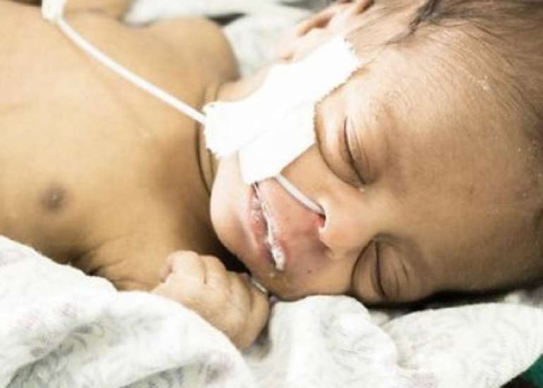 Changing Trends in Organisms Causing Neonatal Sepsis and Their Antibiotic Sensitivity