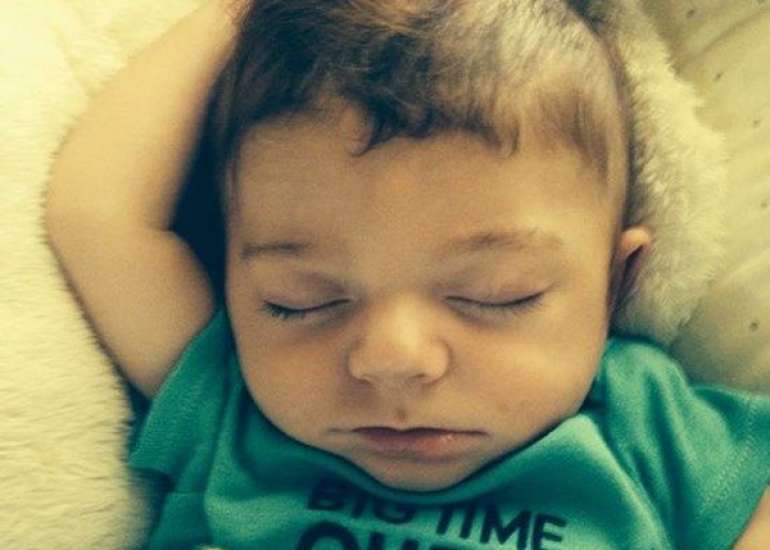 Children with GPI deficiency and their Clinical, laboratory, and mutational profile