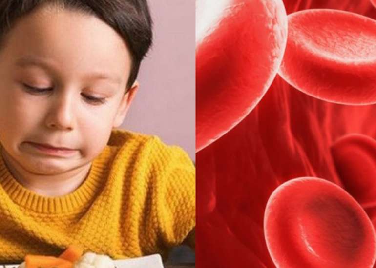 Chronic Iron Deficiency and Cognitive Function in Early Childhood