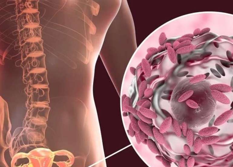 Colloidal Nano silver gel for treating bacterial vaginosis, vulvovaginal candidiasis, and trichomoniasis