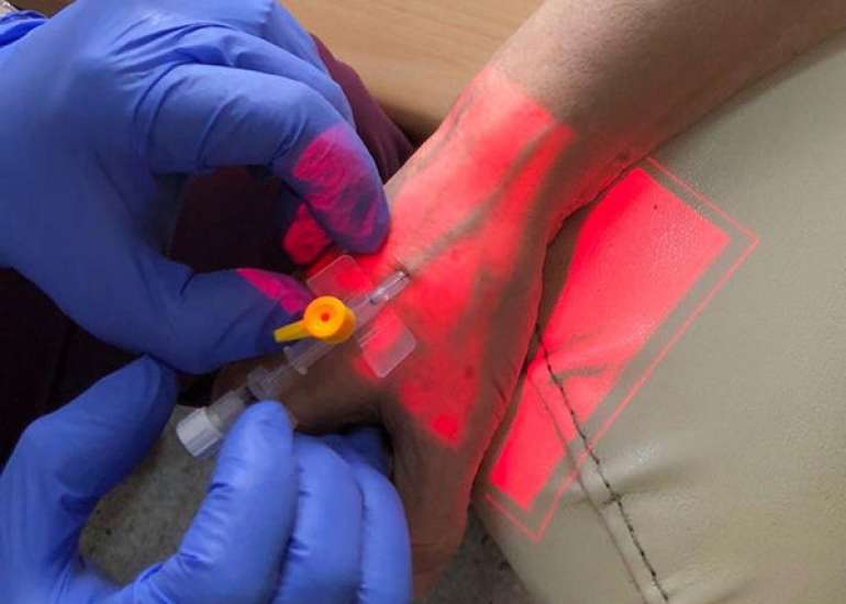 Comparison of LED-Based Transillumination Device for Difficult Intravenous Cannulation in Indian Children