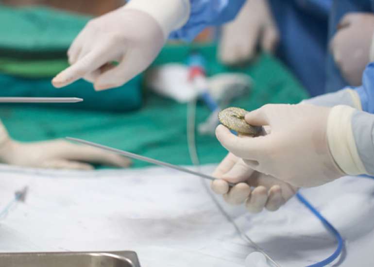 Complication after PCI?