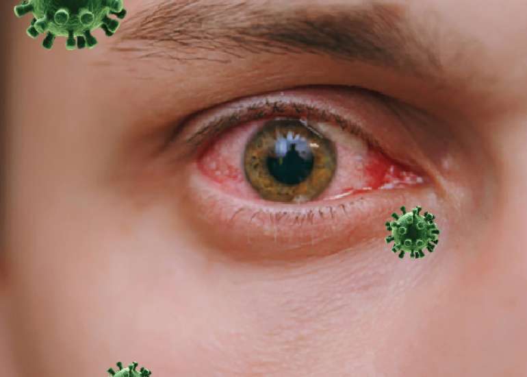 Coronavirus Risk To Your Eyes: Here’s What You Should Know