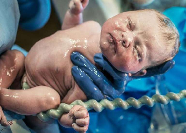 Correlation of umbilical cord arterial blood pH with meconium-stained liquor