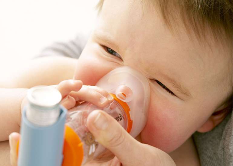 Cytokine profile and lung function in obese and asthmatic children