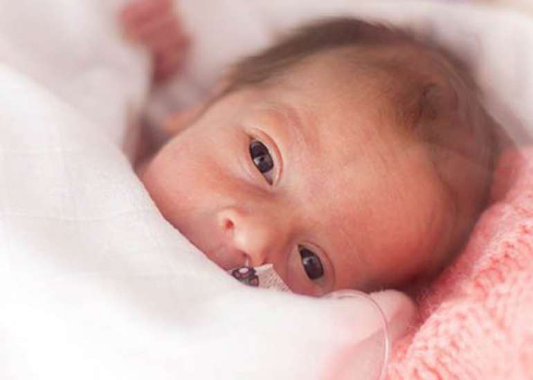 Dexamethasone, Prednisolone, and Methylprednisolone Use and 2-Year Neurodevelopmental Outcomes in Extremely Preterm Infants