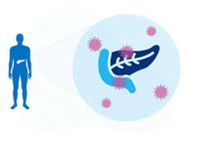 Diabetes, Metabolic Syndrome and COVID-19 patients. 