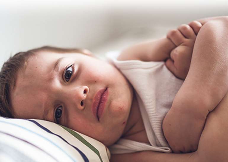 Diagnosing peanut allergy in a child with severe atopic dermatitis