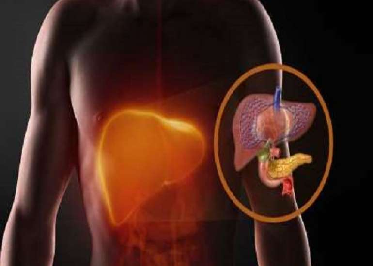 Diagnosis of Alcoholic Liver Disease