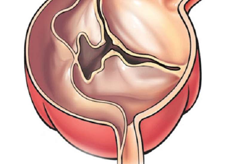 Do i have the flu or a cold? 