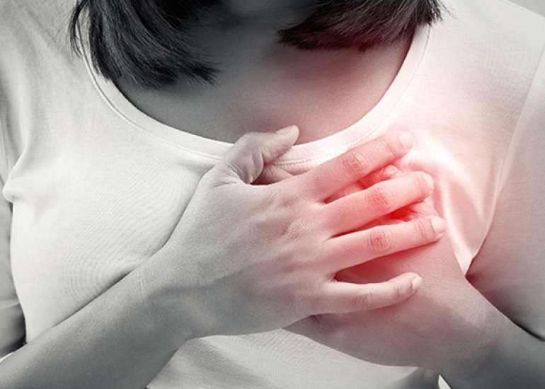 Do women get heart attack?