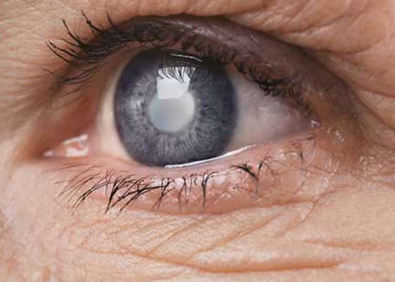 Does every patient of glaucoma require treatment?