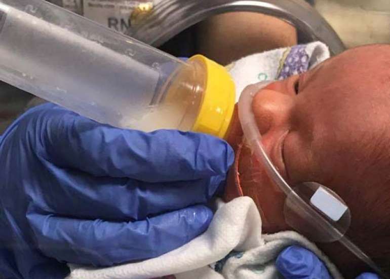 Early Human Milk Fortification in Infants Born Extremely Preterm