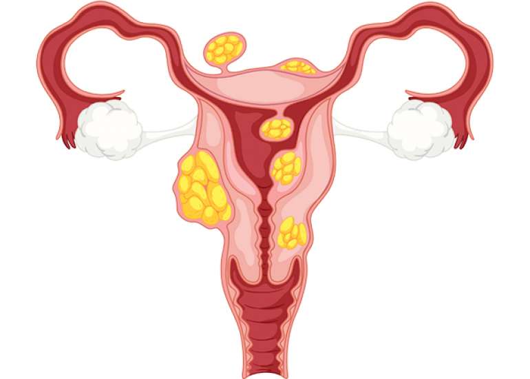 Efficacy and Safety of mRNA COVID-19 Vaccines in Children between the Ages of 5 to 11 Years
