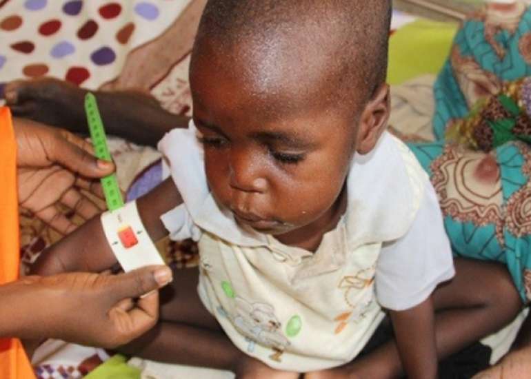 Evaluation of Child Undernutrition Anthropometric Indicators across Low- and Middle-Income Countries