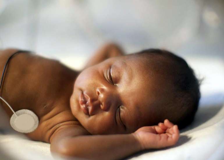 Evaluation of Pulse Rate, Oxygen Saturation, and Respiratory Effort after Different Types of Feeding Methods in Preterm Newborns