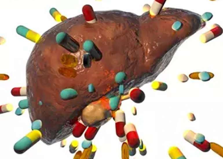 Drug Induced Liver Injury