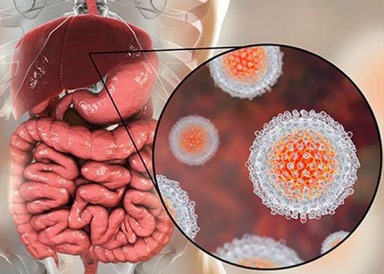 Hepatitis A and its Treatment